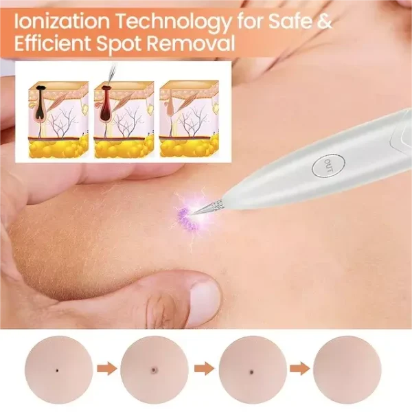 Ion Laser Dark Spot Remover Pen