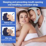 Anti Snoring Chin Strap,Chin Strap For Cpap Users Adjustable And Breathable Chin Strap Provide The Effective Snoring Solution To Stop Snoring Sleep Aid Snore Reducing Aid For Woman And Men.